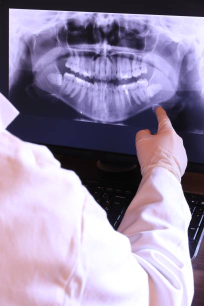 Best Broken or Chipped Tooth Repair in Mathews, LA
