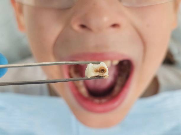 Best Urgent Dental Care for Toothaches in Mathews, LA