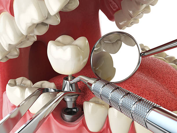 Best Weekend Emergency Dental Services in Mathews, LA
